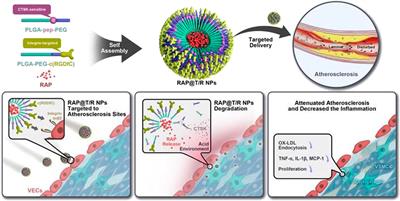 Atherosclerosis treatment with nanoagent: potential targets, stimulus signals and drug delivery mechanisms